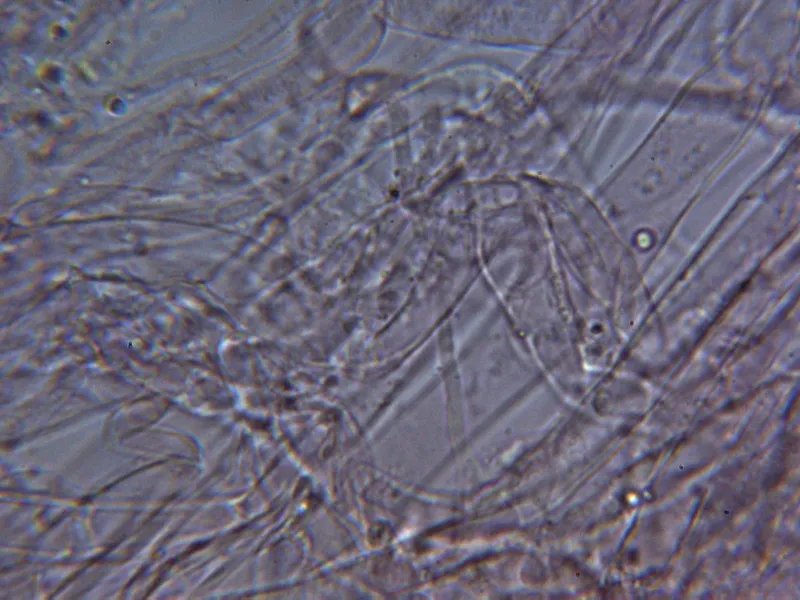 Calyptella capula 10 - Hifas contexto